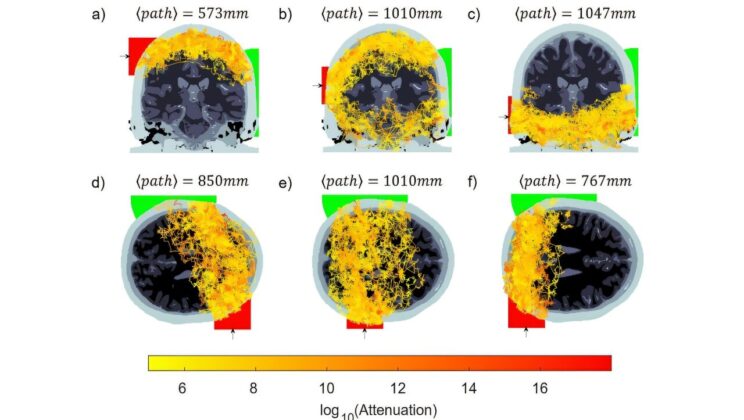 Light Travels Through a Human Head for the First Time