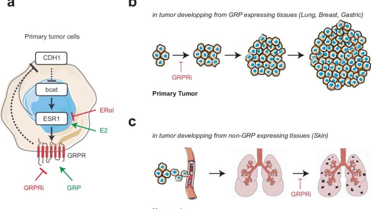 A Hidden Hormonal Pathway in Women May Explain Melanoma’s Deadly Turn