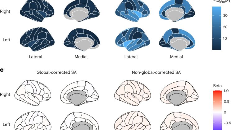 New Study Reveals Brain Structure Can Predict Risk for Schizophrenia and Cognitive Ability