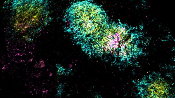 Scientists Discover Long-Lasting Immune Boost with Two-Ingredient HIV Vaccine