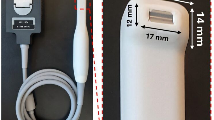 Goodbye to Painful Probing as Ultrasound Device Transforms Dental Checkups