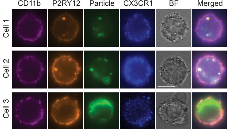 Scientists Grow Human Microglia in Just Four Days to Transform Brain Disease Research