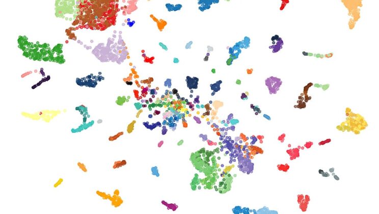 AI Breakthrough Diagnoses Brain Tumors Without Surgery