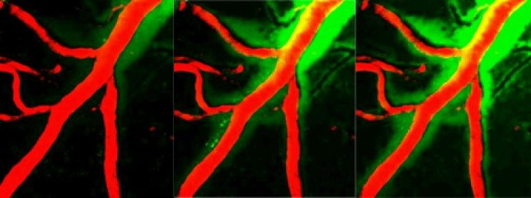 How Scientists Are Teaching the Brain to Clean Itself and Fight Alzheimer’s