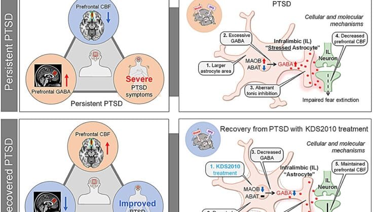 Scientists Discover Hidden Brain Cells Holding PTSD Memories Hostage