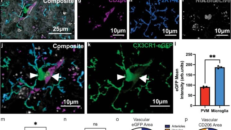 The Tiny Brain Cells That Could Hold the Secret to Beating Alzheimer’s