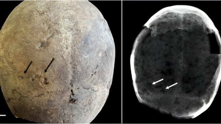 The Secret Hidden in a 400-Year-Old Brain