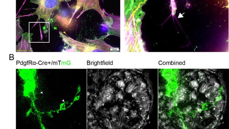 Your Gut May Be Thinking More Like a Brain Than We Ever Imagined
