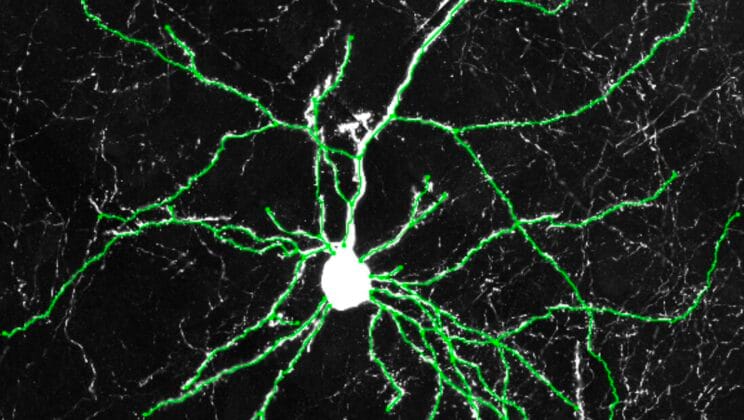 The Sleep Gene That May Have Helped Build the Human Mind