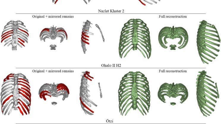 The Mystery Inside Ötzi’s Ribcage Changes Everything We Thought About Our Past
