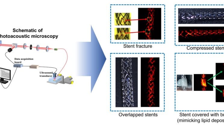 Scientists Just Found a Way to See Inside the Body Without Cutting It Open