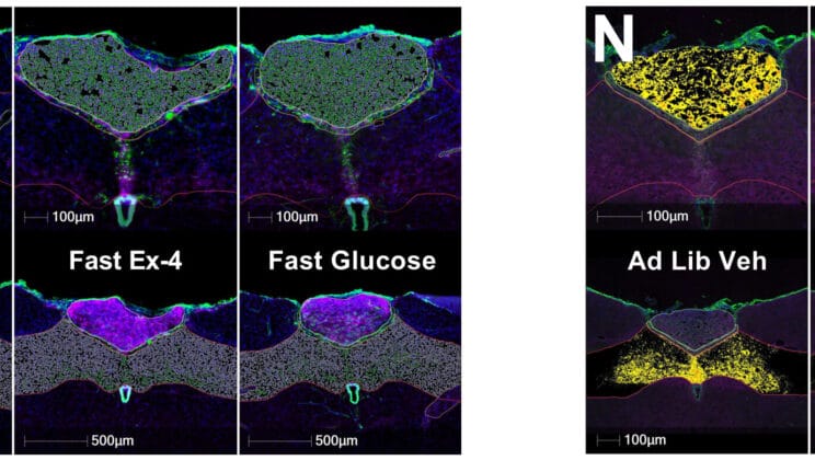 Scientists Find a Hidden Brain Signal That Silently Ends Hunger Without Side Effects