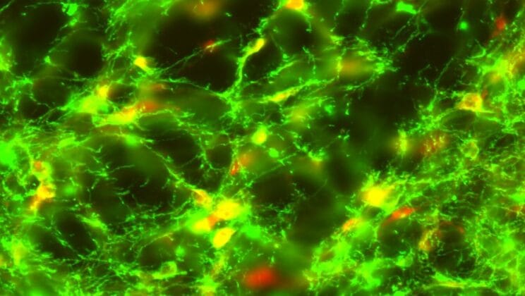 Why Some Rats Lick the Bell and What It Reveals About the Human Brain