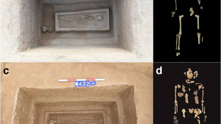 The 2,500-Year-Old Amputation Mystery Finally Explained