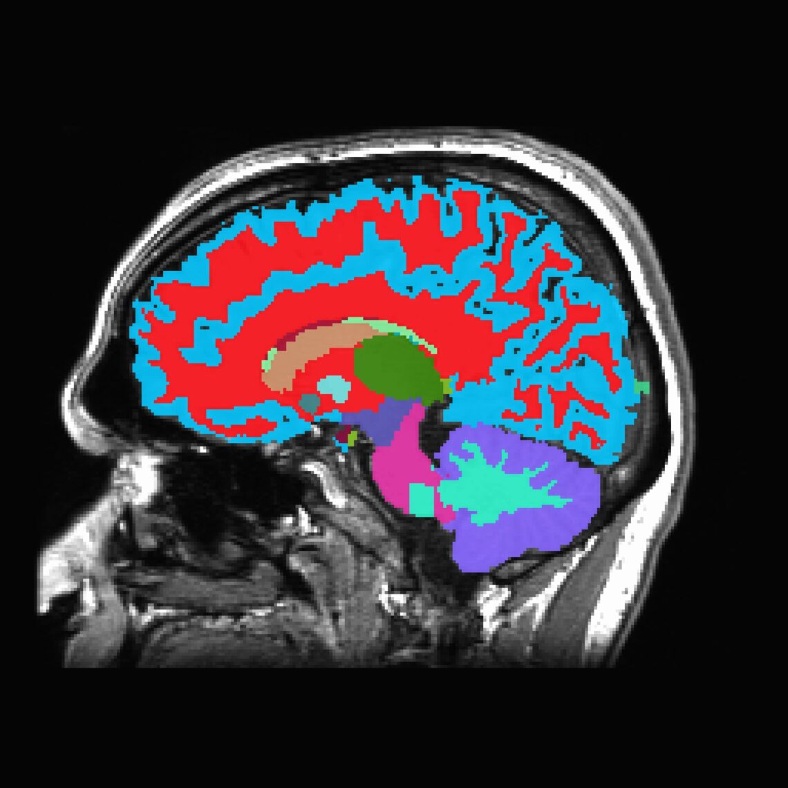 10 Best Exercises to Improve Brain Function