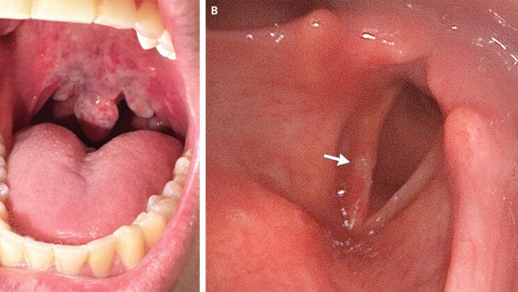 The Strange Science of Nitrous and the Risks No One Talks About