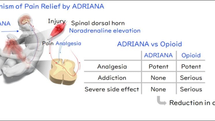 Scientists Discovered a New Way to Stop Pain Without Addiction
