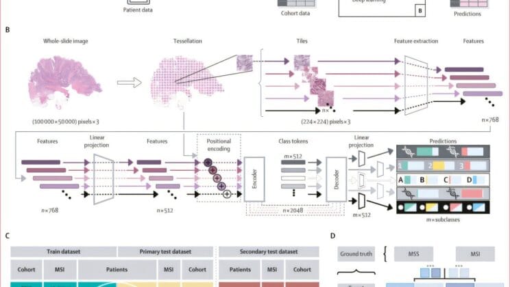 Artificial Intelligence Learns to Read Cancer’s Hidden Genetic Code