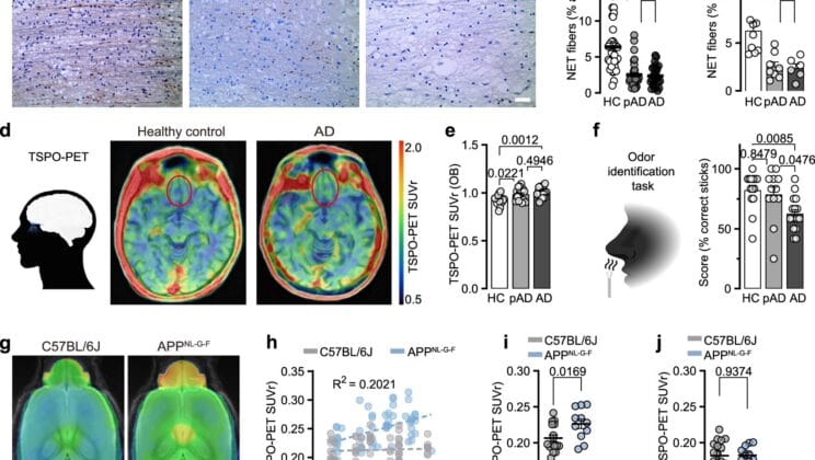 Scientists Uncover How the Nose Warns of Alzheimer’s Years Before Memory Fades
