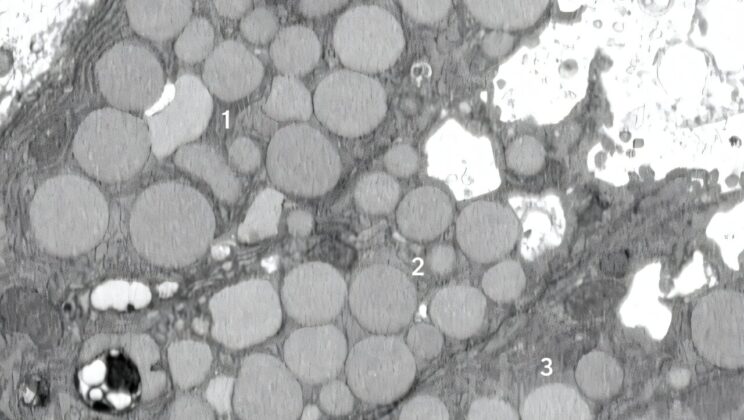 Scientists Uncover Secret Cellular Cleanse That Could Redefine Healing