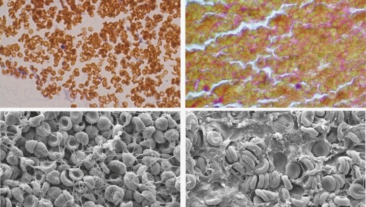 Scientists Discover a Hidden Force Inside Your Blood That Helps Heal Wounds