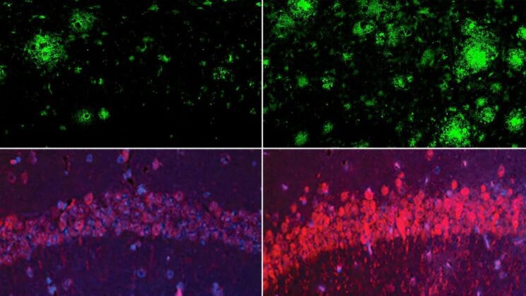 The Element That Silently Shields Your Brain from Alzheimer’s