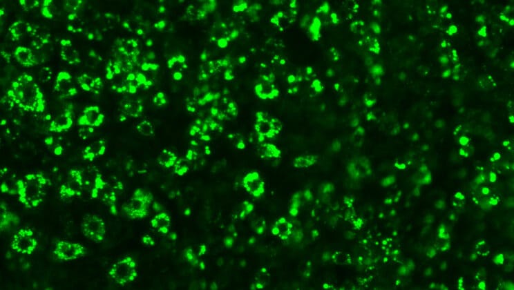 Scientists Unearth Hidden Proteins That Could End the Obesity Epidemic