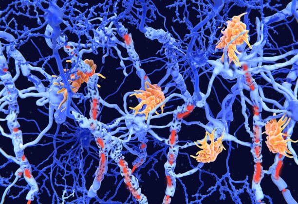 What Are Autoimmune Diseases and How Are Microbes Involved?