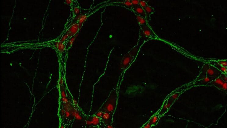 Scientists Discover Gut Neurons Hold the Key to Stopping Inflammation