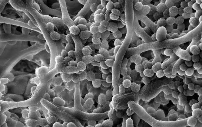 Biofilms: How Bacteria Stick Together to Survive