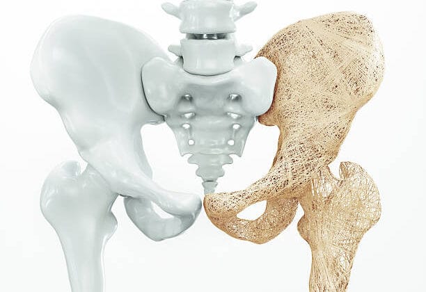 Everything You Need to Know About Osteoporosis and Bone Health