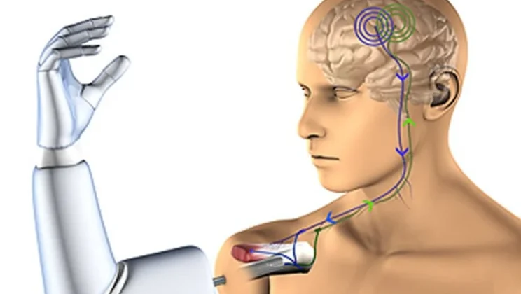 Could Mind-Controlled Prosthetics Become Reality?