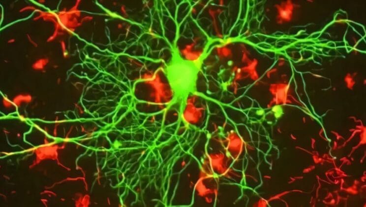 This Cellular Power Switch Could Be the Key to Stopping Alzheimer’s Forever