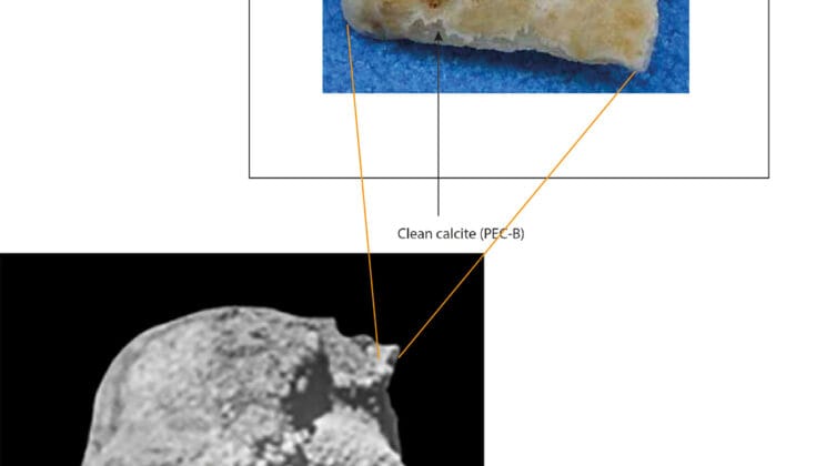 The Skull That Challenges Everything We Thought We Knew About Human Origins