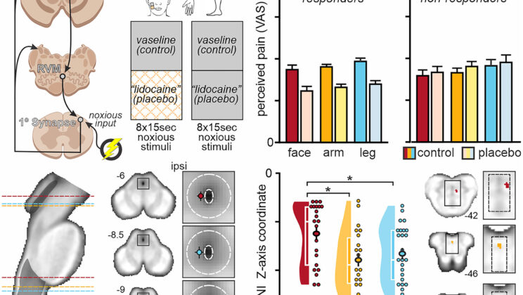 Scientists Uncover Hidden Map in the Brain That Shows Where Pain Lives and How it Can Be Silenced