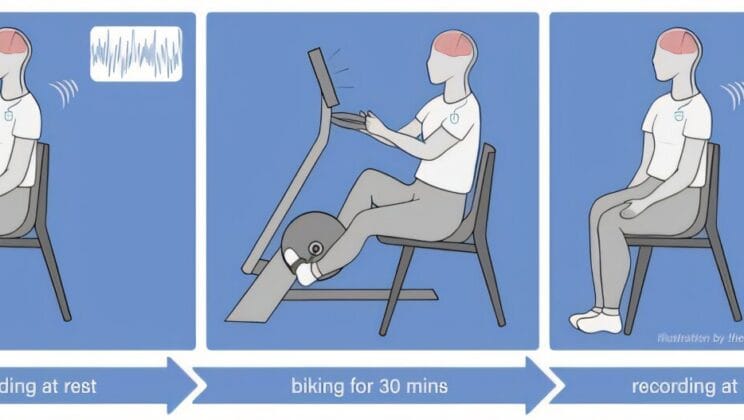 Scientists Discover Exercise May Rewire the Brain in Parkinson’s Patients