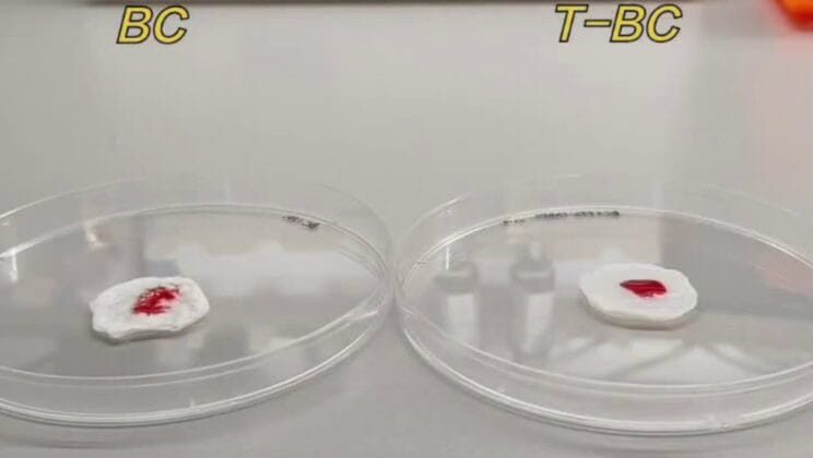 Scientists Create a Bandage That Stops Bleeding in Seconds and Heals Burns Faster Than Ever