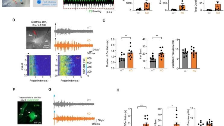 Scientists Uncover a Tiny Brain Region That May Hold the Secret to Autism