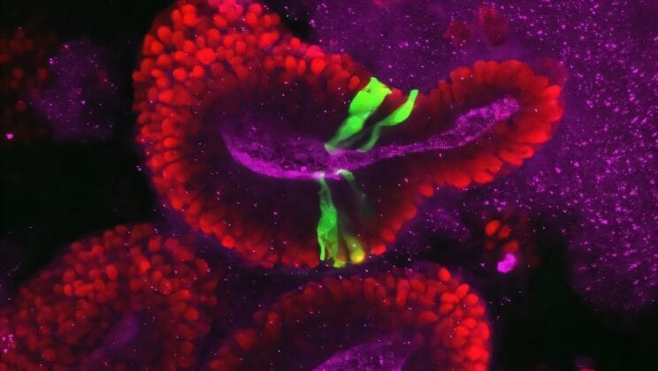 Why the Brain’s First 15 Days May Hold the Secret to Neurodevelopmental Disorders