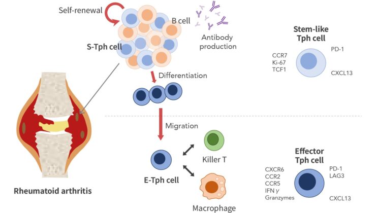 Scientists Uncover Hidden Immune Cells That May Hold the Secret to Stopping Rheumatoid Arthritis