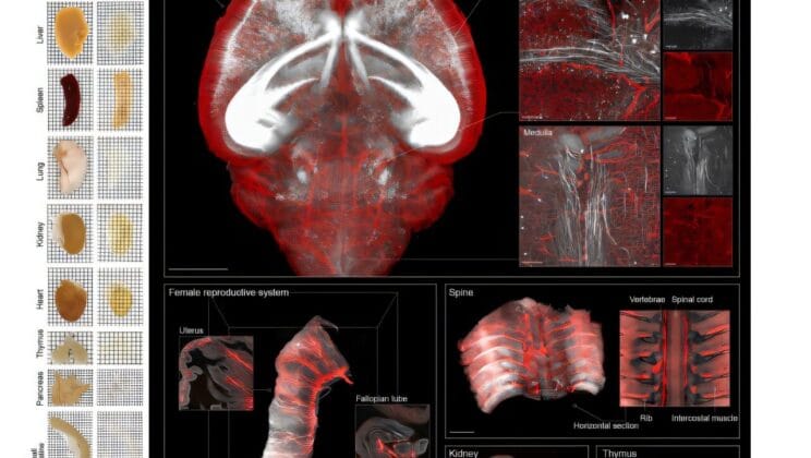 Scientists Discover How to Make the Human Brain Turn Transparent