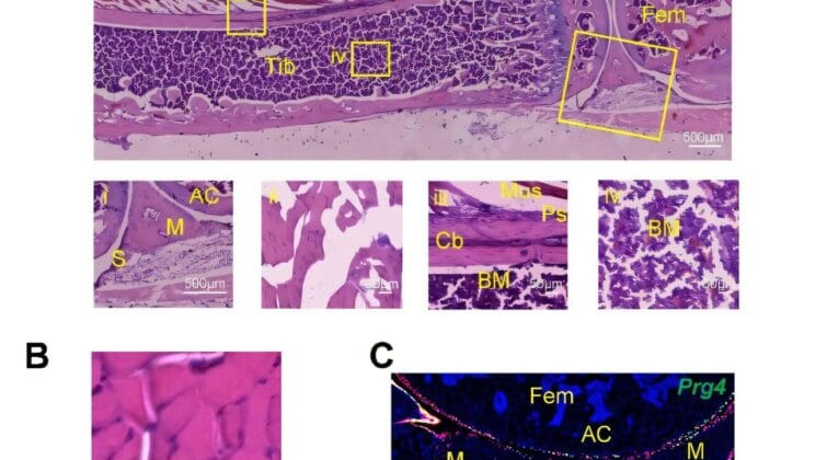 Scientists Uncover Muscle Cells That Transform Into Bone After Injury