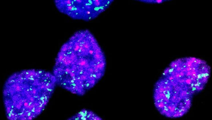 Scientists Uncover the Hidden DNA Rings That Help Childhood Cancer Outsmart Treatment