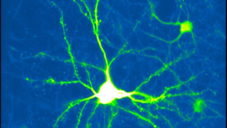 Your Brain Feels Touch Differently Than You Think and Now We Know Why