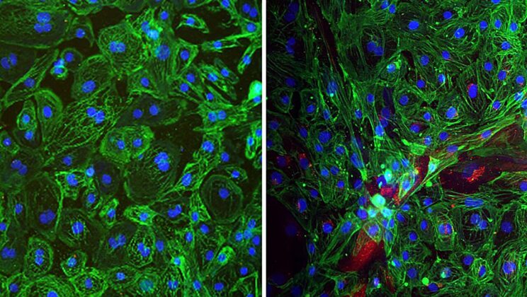 Scientists Grow Mini Human Organs to Unveil the Secrets of a Deadly Virus