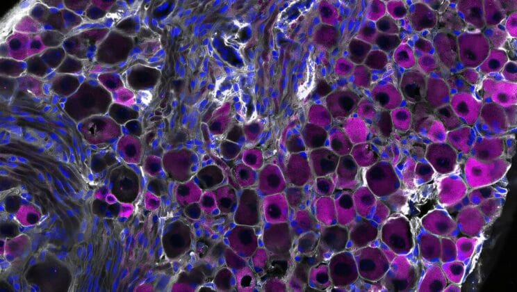 The Nerve Cells Hidden in Our Lungs That Hold the Secret to Surviving the Flu