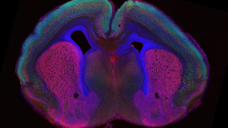 Human Brain Wrinkles May Hold the Secret to Our Intelligence