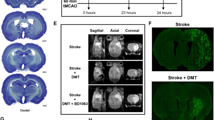 Scientists Discover Psychedelic Compound That Could Heal the Brain After Stroke