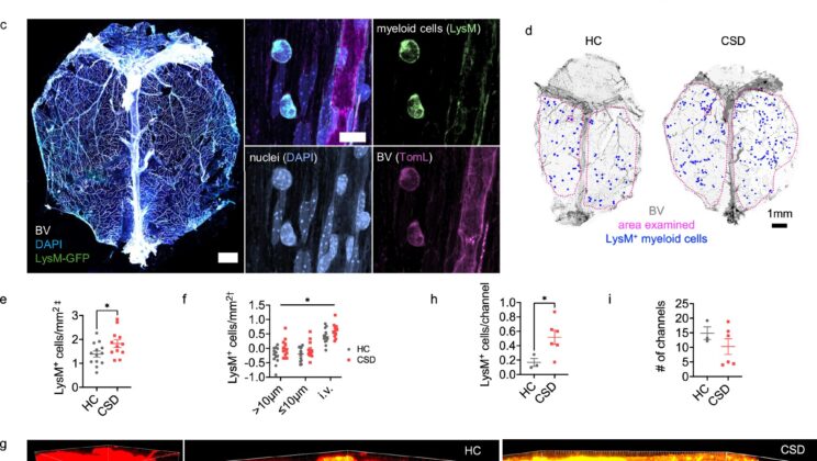 Your Immune System Might Be Secretly Fueling Depression—Here’s the Breakthrough Discovery