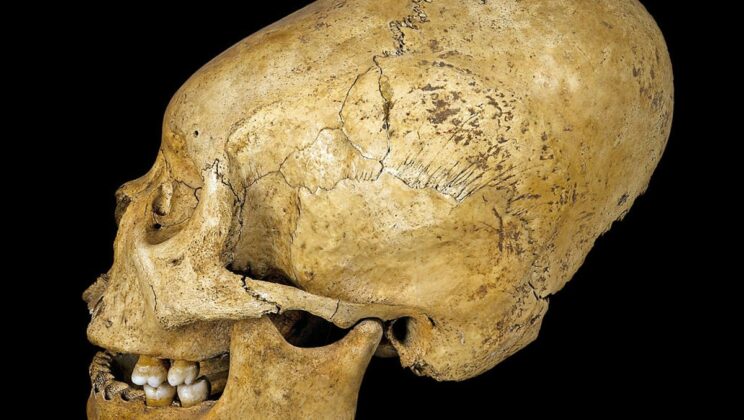 The Unusual Cranial Elongation Practices in Ancient Peru